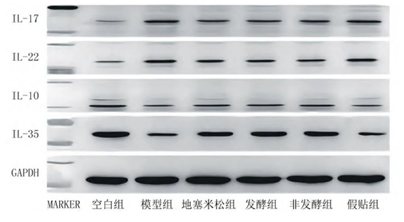 空白組和支氣管哮喘各組大鼠肺組織中IL－17、IL－22、IL－10、IL－35蛋白表達(dá)電泳圖